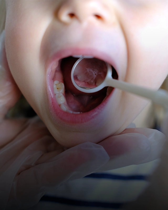 Dental Mirror In A Child's Mouth As they Receive An Exam